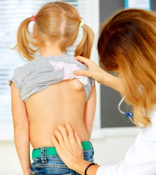 Σκολίωση & Παιδιά: Όλα όσα πρέπει να γνωρίζουν οι γονείς!