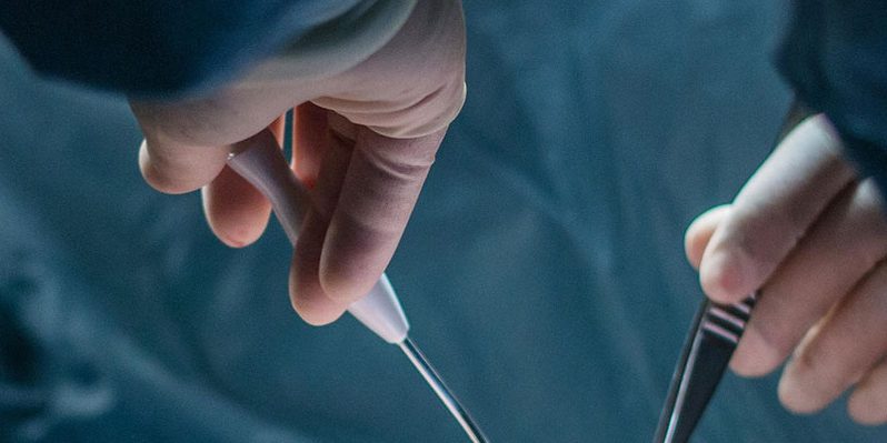 Συρραμμένη αιμορροϊδεκτομή Συρραμμένη αιμορροϊδεκτομή