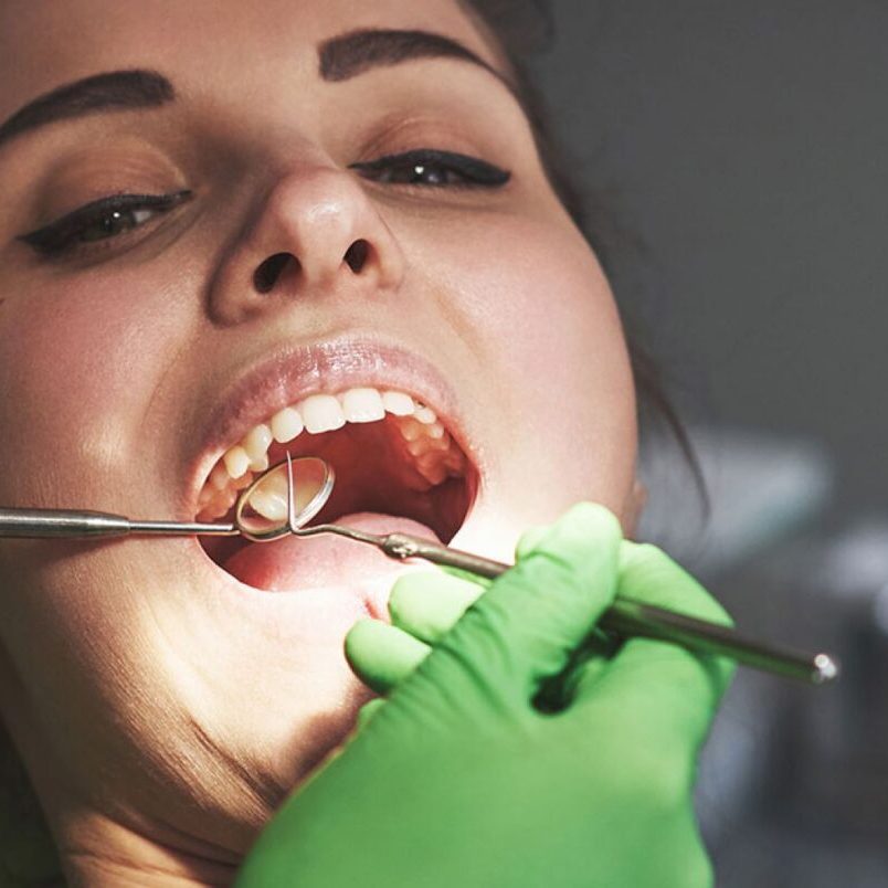 Συχνές ερωτήσεις σχετικά με τα οδοντικά εμφυτεύματα