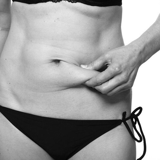 Τα Πάντα για την Πλαστική Κοιλιάς!