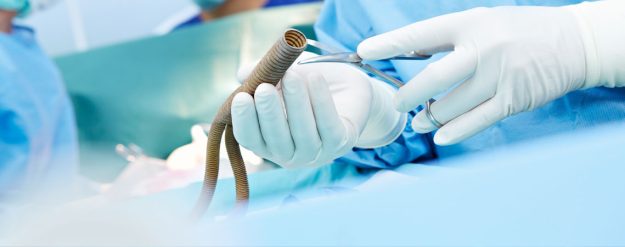 Τι Είναι Η Αγγειοχειρουργική;