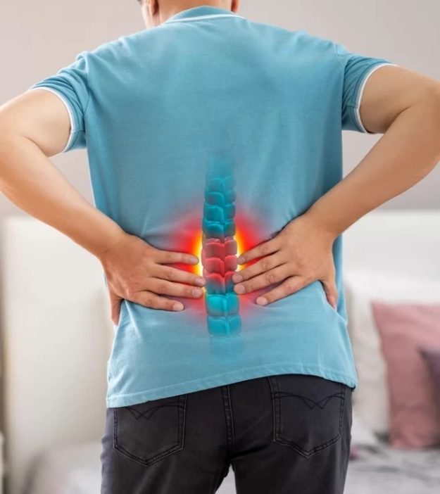 Τι είναι η κήλη μεσοσπονδυλίου δίσκου (Δισκοκήλη);