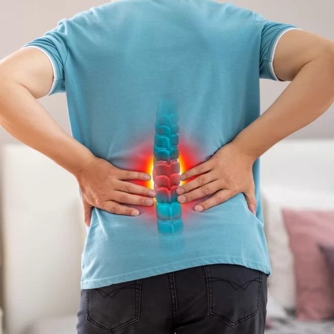 Τι είναι η κήλη μεσοσπονδυλίου δίσκου (Δισκοκήλη);