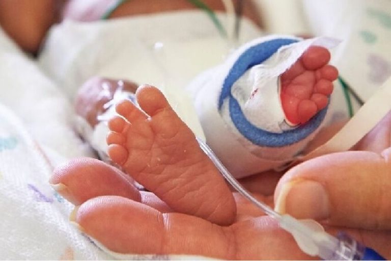 Τι είναι η νεκρωτική εντεροκολίτιδα Τι είναι η νεκρωτική εντεροκολίτιδα