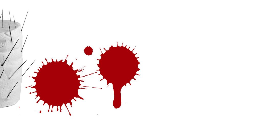 Τι είναι οι υπερτροφικές πρωκτικές θηλές;