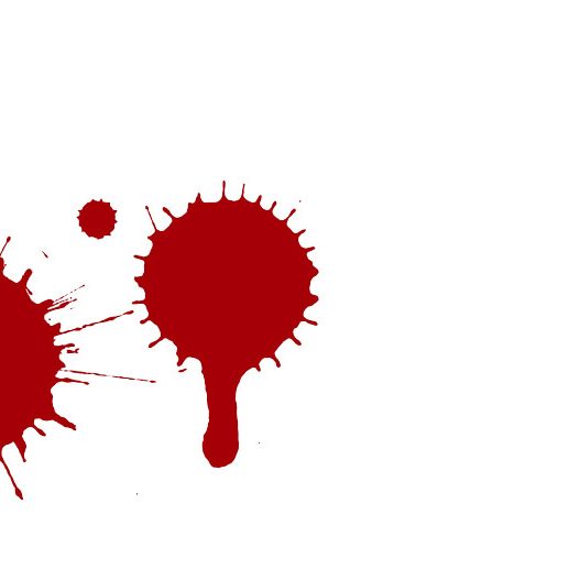 Τι είναι οι υπερτροφικές πρωκτικές θηλές;