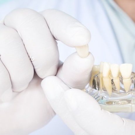 Τι είναι τα μικροεμφυτεύματα;