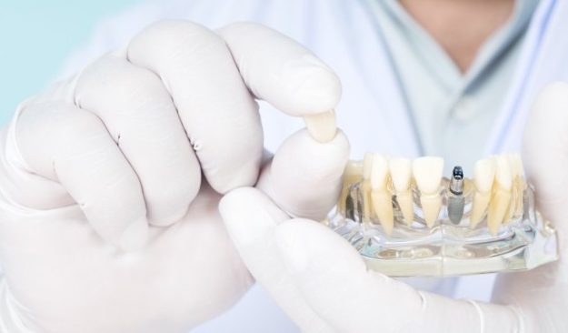 Τι είναι τα μικροεμφυτεύματα;