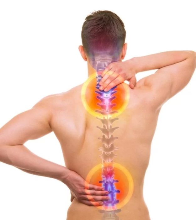 Τι πρέπει να γνωρίζετε για την ελάχιστα επεμβατική χειρουργική της σπονδυλικής στήλης (MISS)