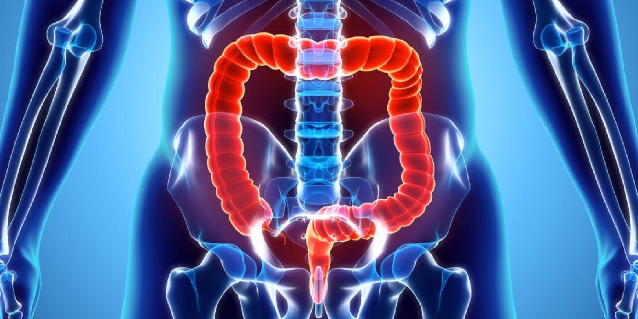 Τι πρέπει να γνωρίζετε για την ισχαιμική κολίτιδα