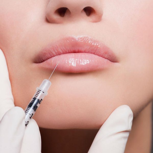 Υαλουρονικό στα Χείλη