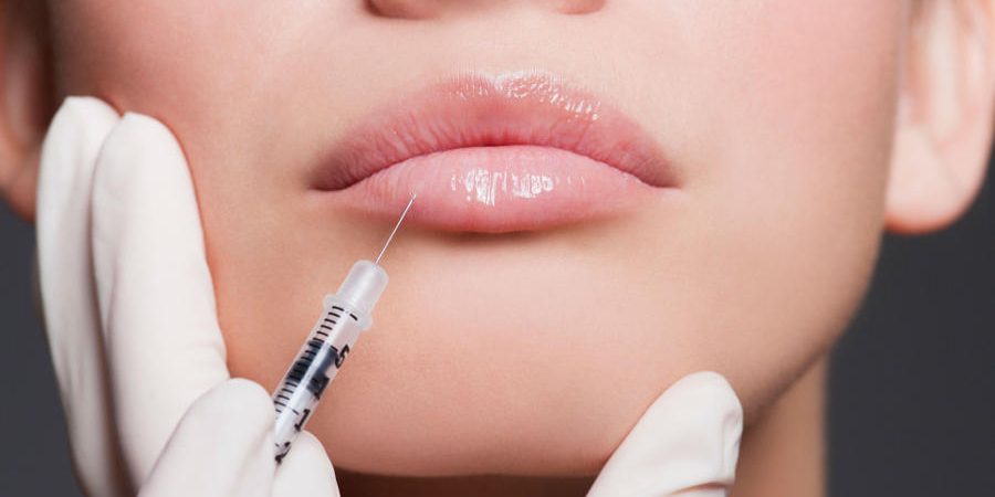 Υαλουρονικό στα Χείλη