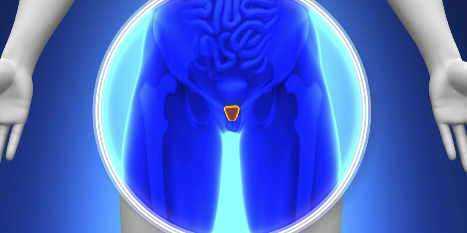 Υπέρηχος όρχεων Υπέρηχος όρχεων