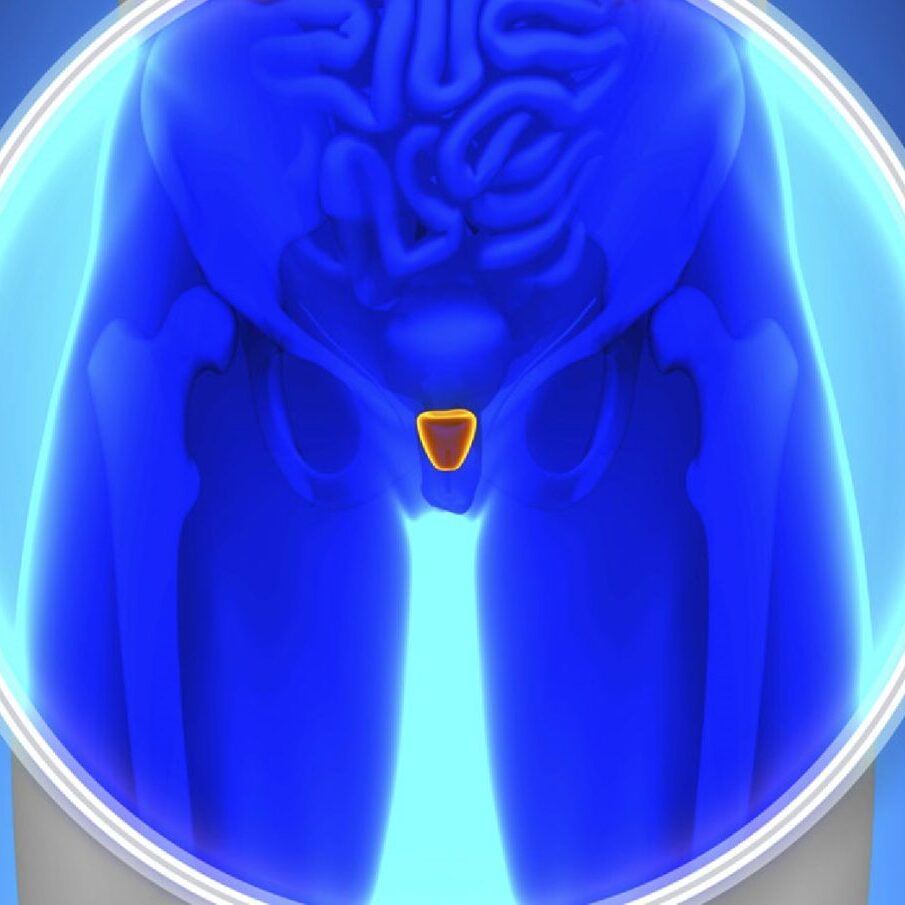 Υπέρηχος όρχεων