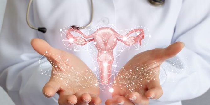 Υστεροσκοπική αφαίρεση πολύποδα ενδομητρίου