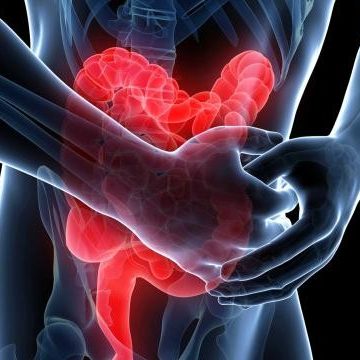 Φλεγμονώδης νόσος του εντέρου, διάγνωση, θεραπεία