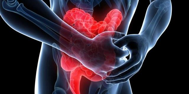 Φλεγμονώδης νόσος του εντέρου, διάγνωση, θεραπεία Φλεγμονώδης νόσος του εντέρου, διάγνωση, θεραπεία