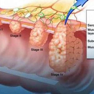 Χειρουργική του ορθού