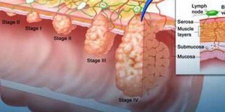 Χειρουργική του ορθού Χειρουργική του ορθού