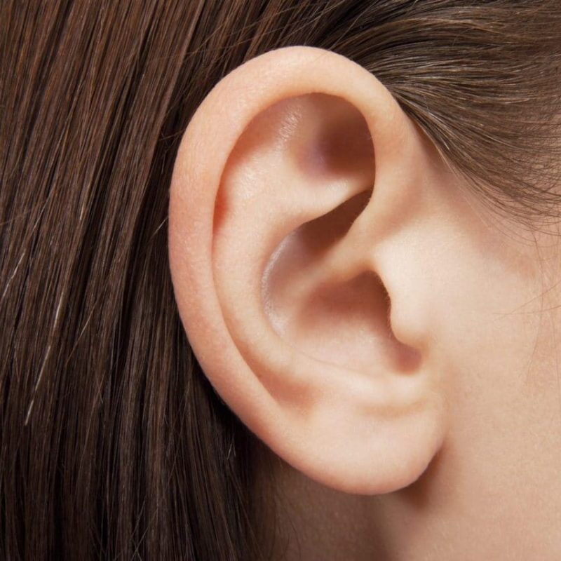 Ωτοπλαστική