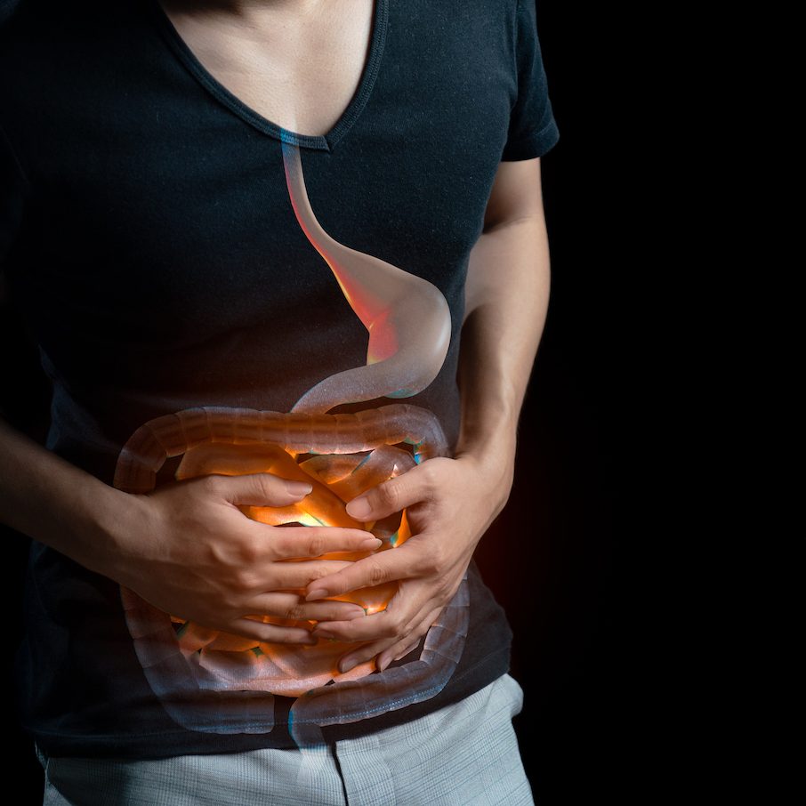 Εκκολπώματα εντέρου