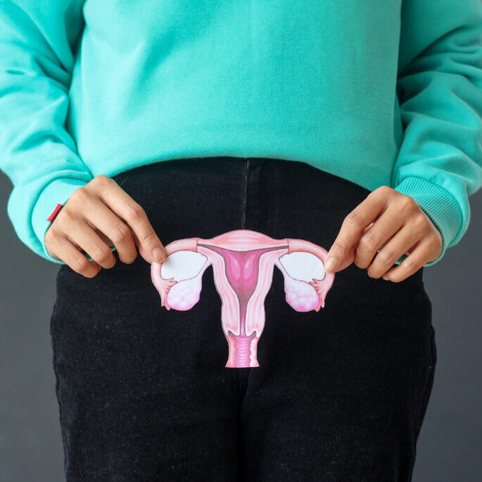 Κύστη στην ωοθήκη