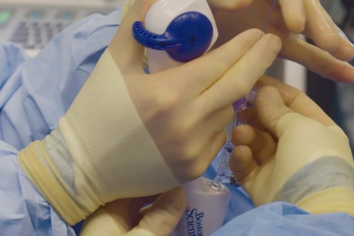 Ουρητηροσκόπηση