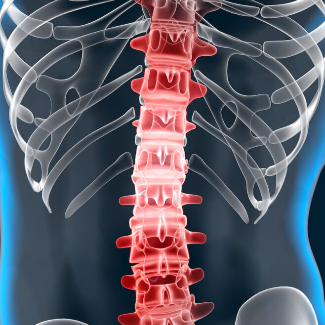 Πίεση νωτιαίου μυελού και συμπτώματα που προκαλεί: Τρόποι αντιμετώπισης