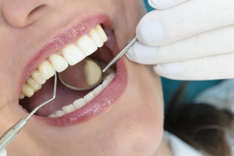 Διάβρωση δοντιών Αίτια επιλογές διαχείρισης | Iatromedia.gr