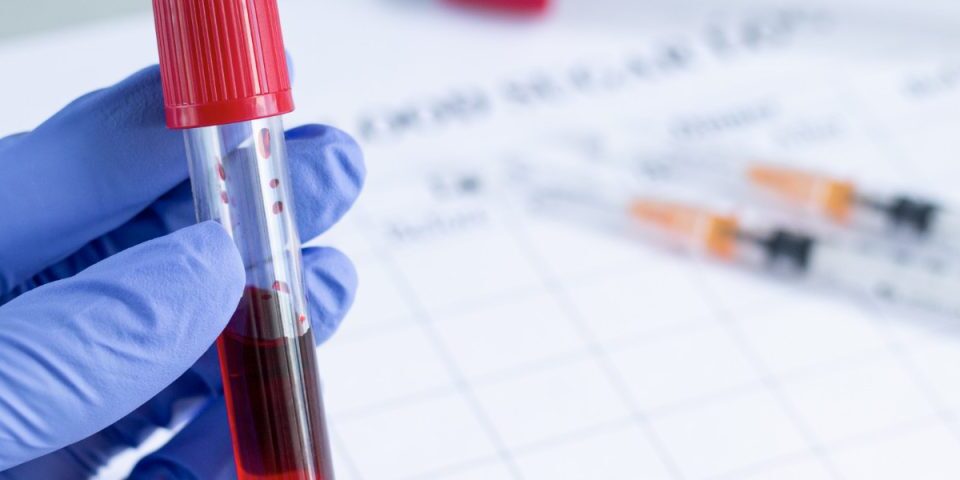 Αιτίες ανεβασμένου PSA και σχέση με καρκίνο προστάτη