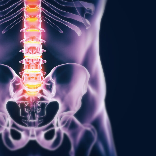 Πώς η οσφυαλγία μπορεί να ανακουφιστεί αποτελεσματικά