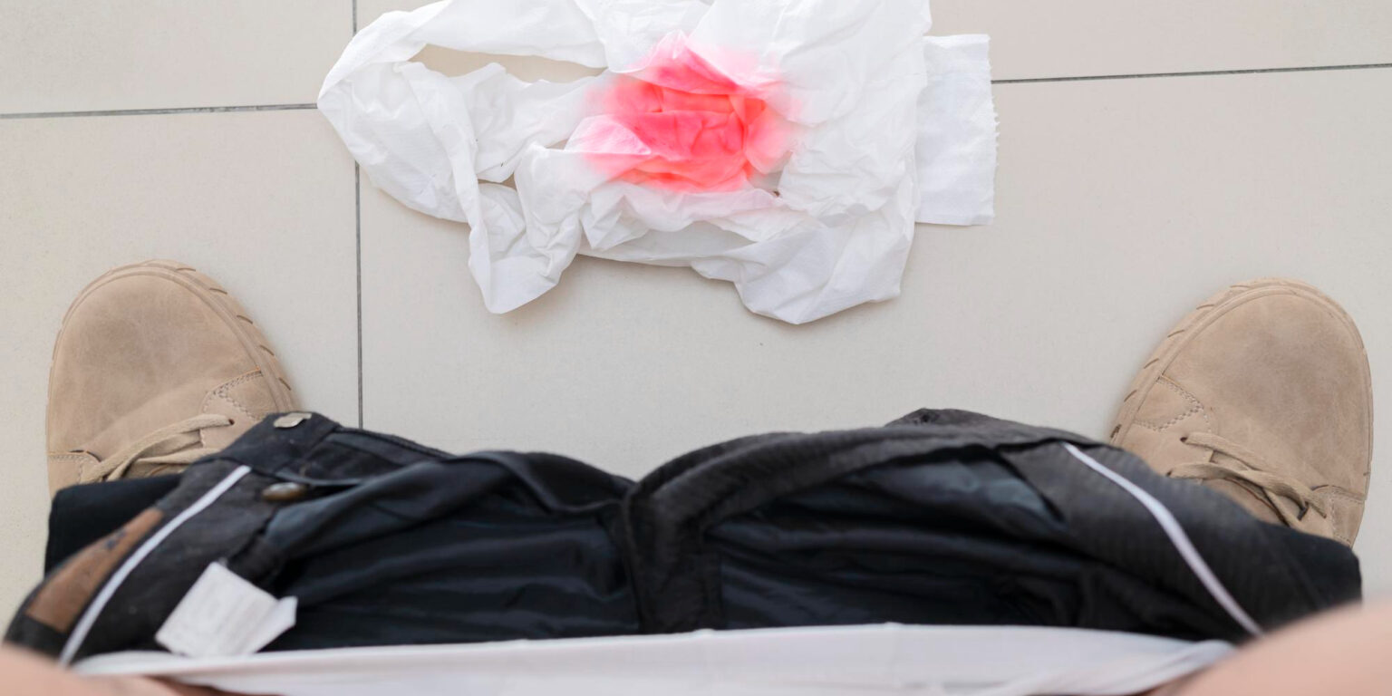 Αίμα από τις αιμορροΐδες: Είναι ανησυχητικό;