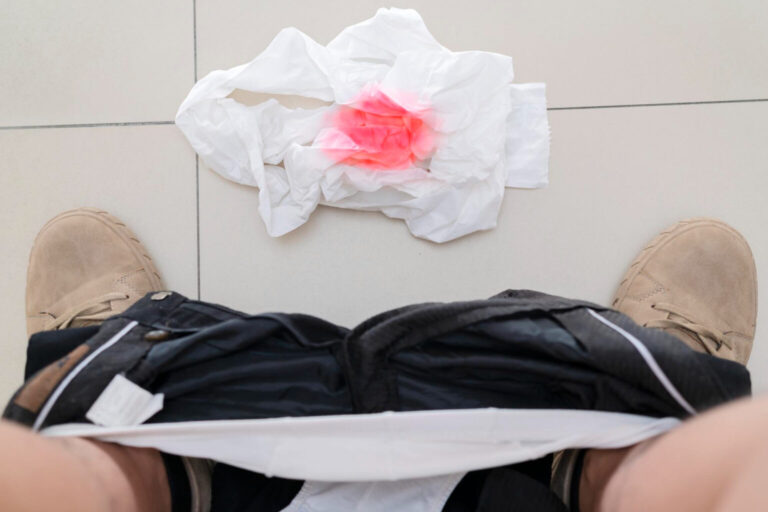 Αίμα από τις αιμορροΐδες: Είναι ανησυχητικό;