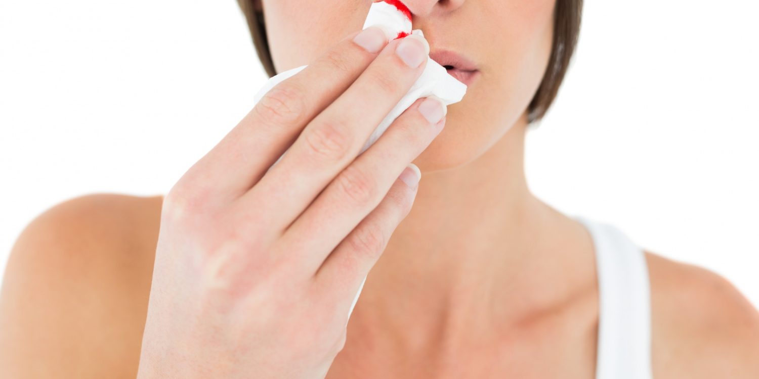 Ρινορραγία: Αίτια & αντιμετώπιση Ρινορραγία: Αίτια & αντιμετώπιση