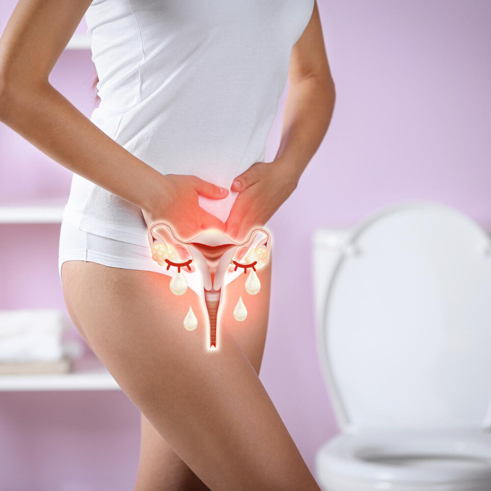 ενδομητρίωση