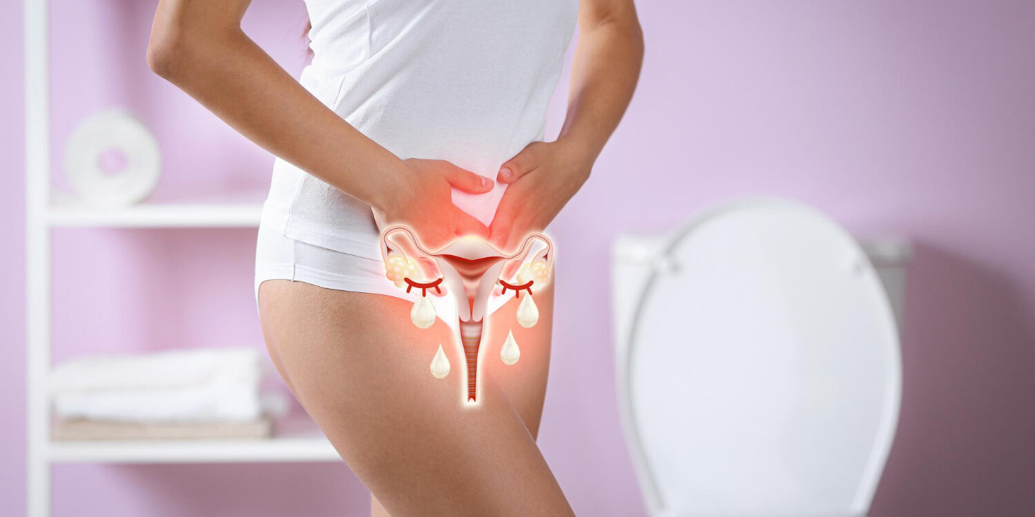 ενδομητρίωση