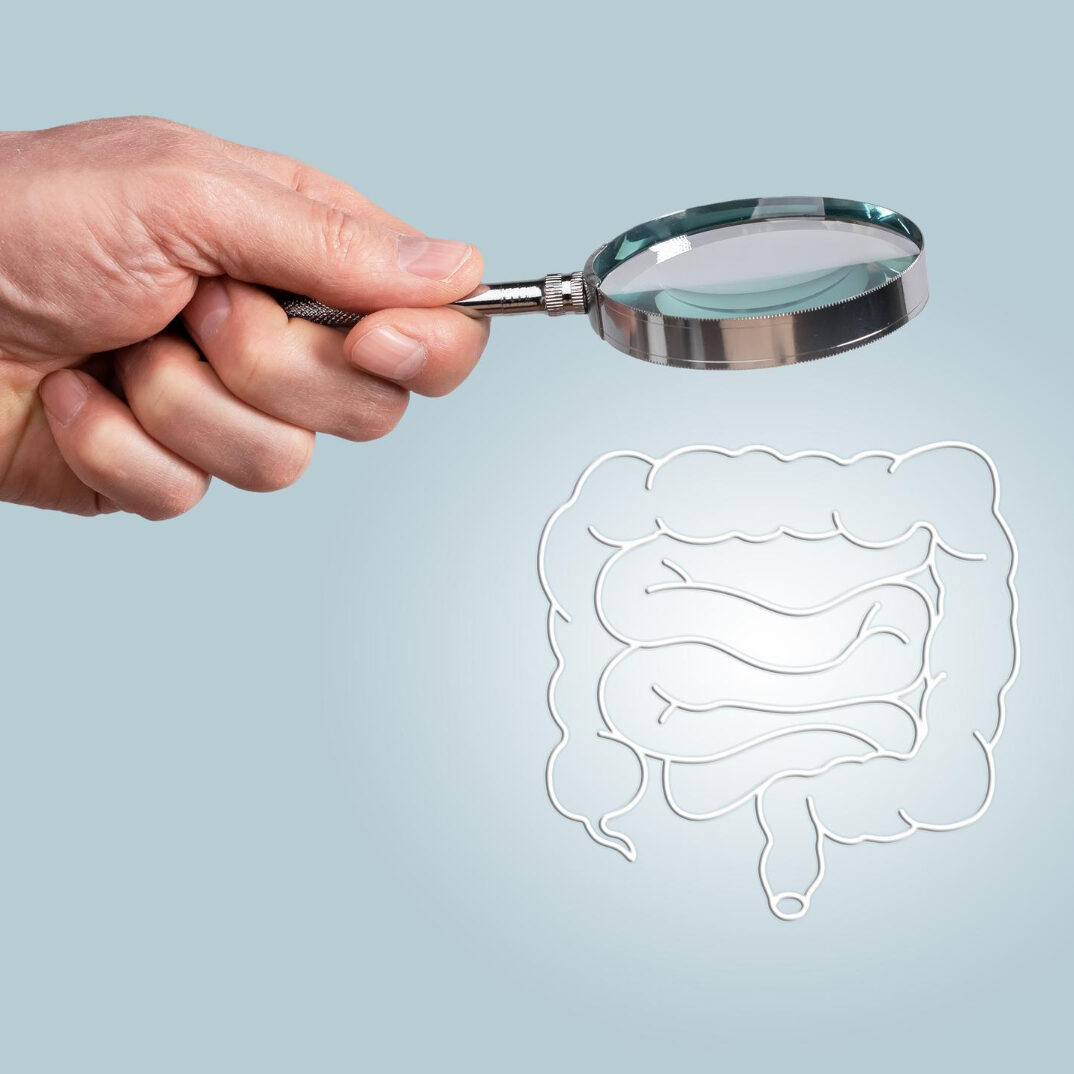 κολονοσκόπηση