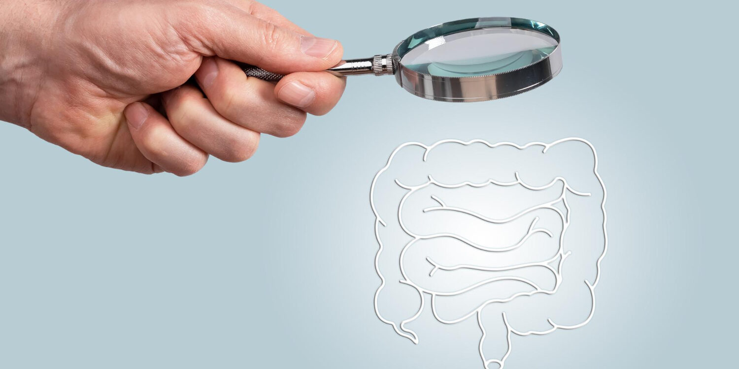 κολονοσκόπηση κολονοσκόπηση