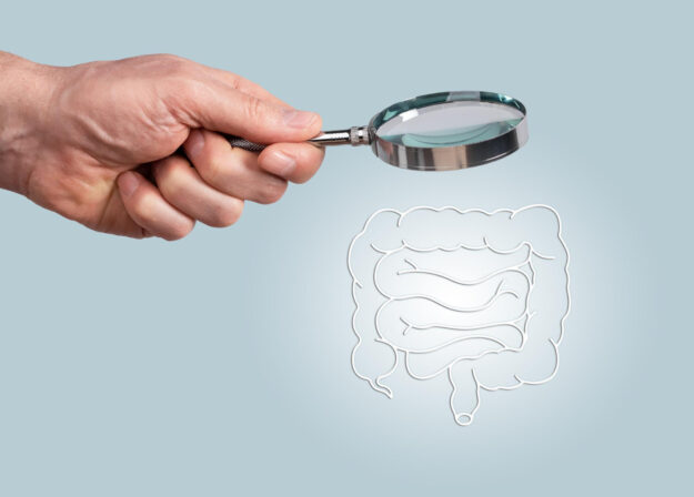 κολονοσκόπηση