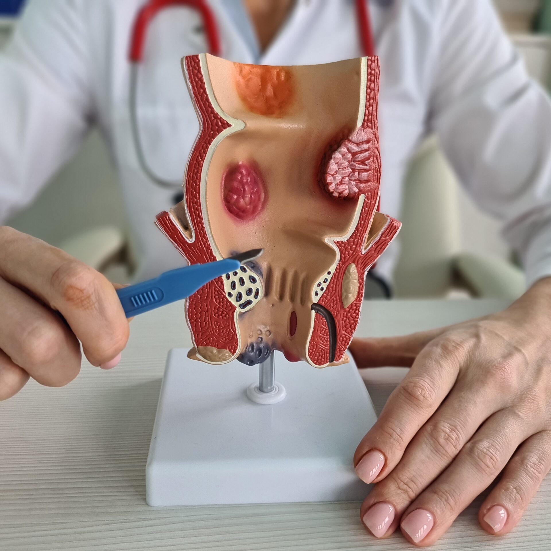 Καλύτεροι Πρωκτολόγοι στην Ελλάδα