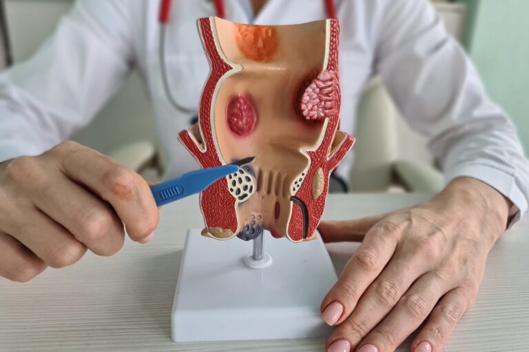 Καλύτεροι Πρωκτολόγοι στην Ελλάδα