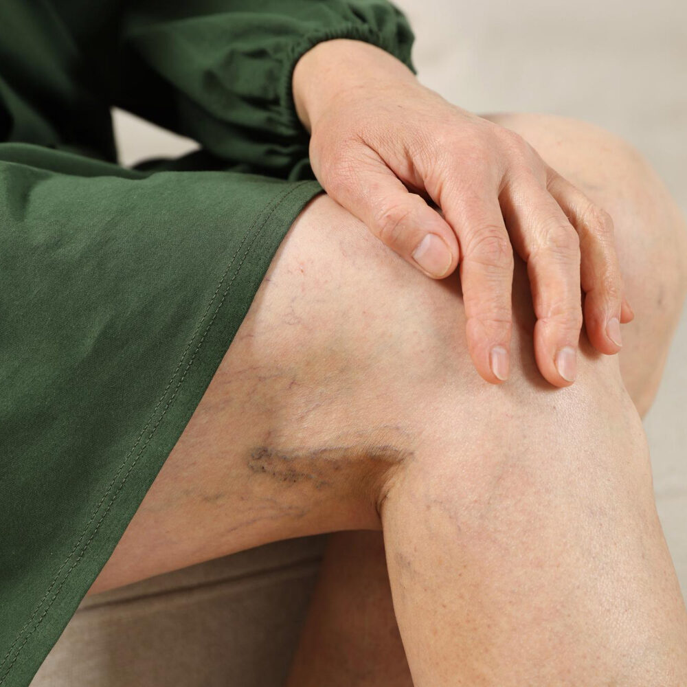 Οι Καλύτεροι Αγγειοχειρουργοί στην Ελλάδα