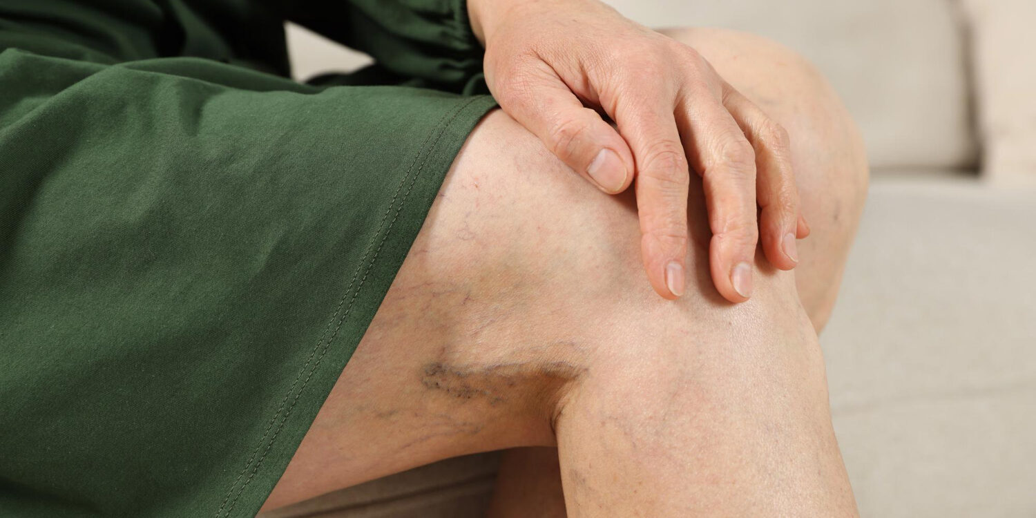 Οι Καλύτεροι Αγγειοχειρουργοί στην Ελλάδα Οι Καλύτεροι Αγγειοχειρουργοί στην Ελλάδα