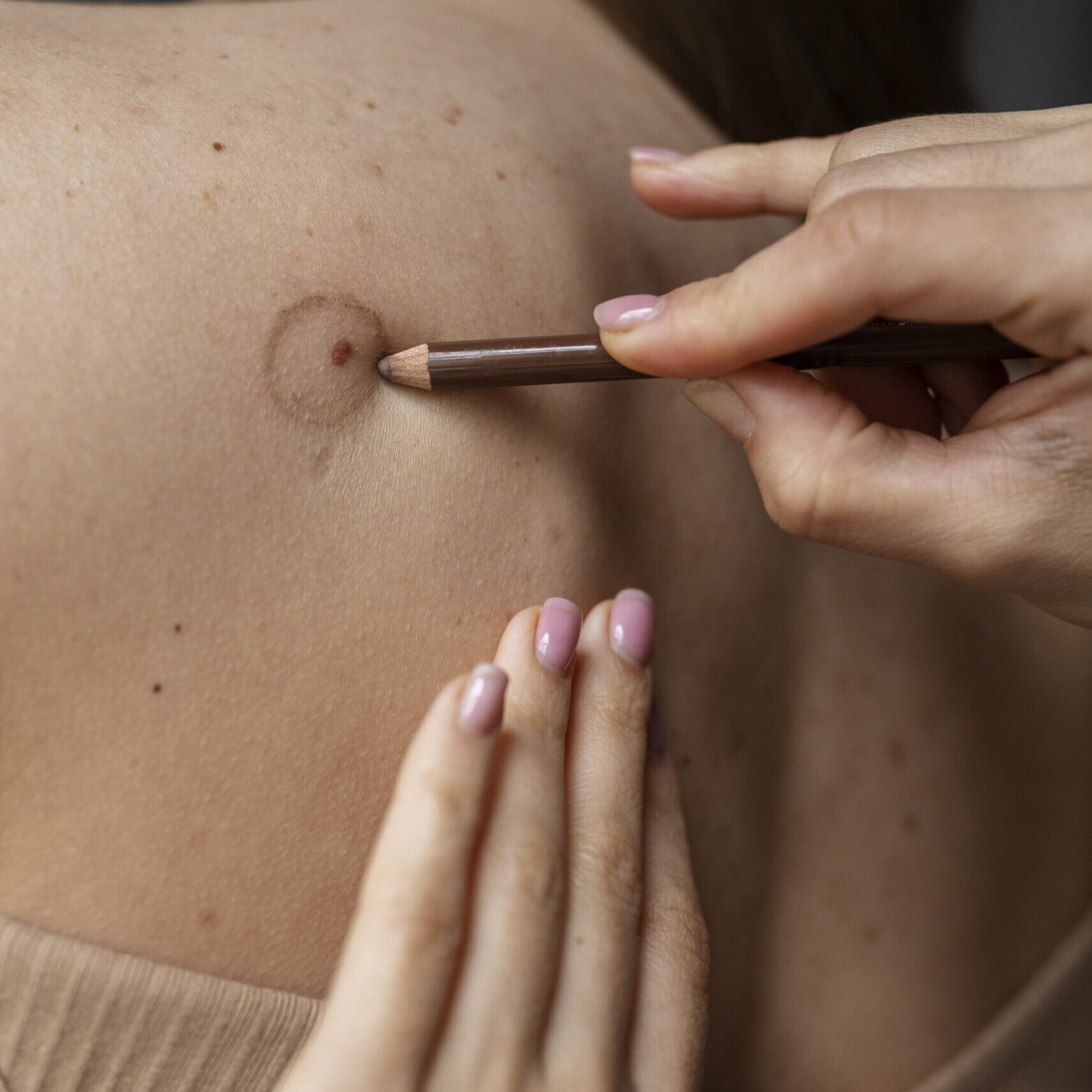 Πότε έκανες τον τελευταίο έλεγχο σπίλων;