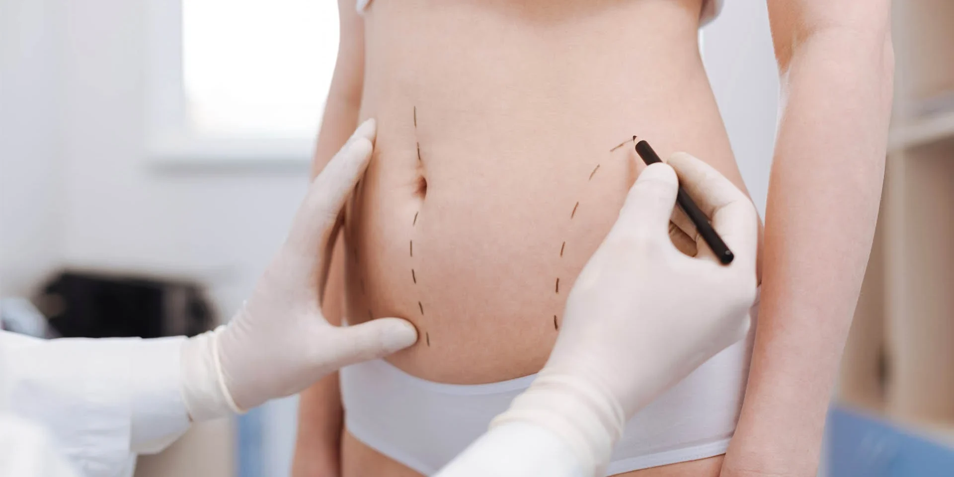 lipoanarrofisi vaser