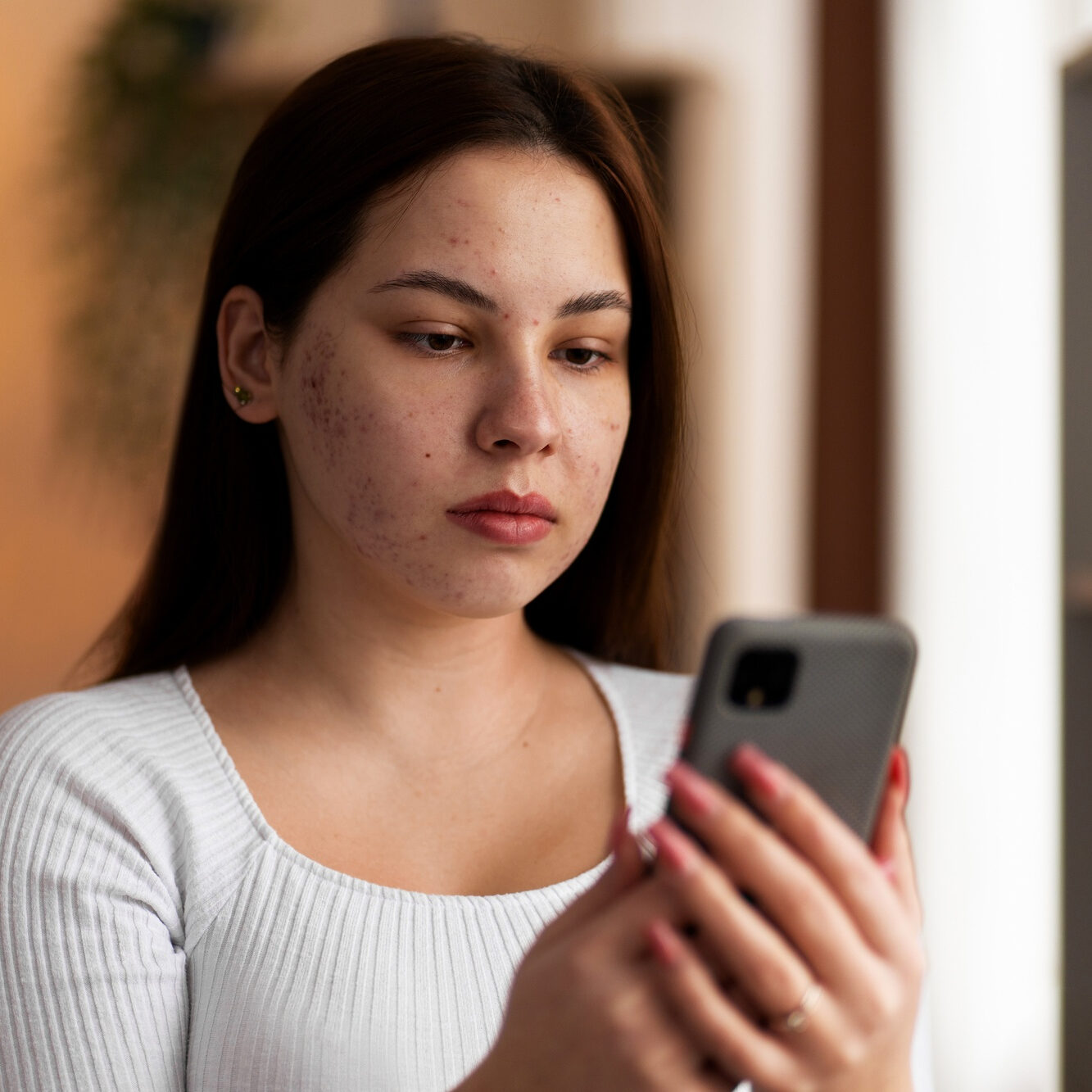 Αν η ακμή ήταν άτομο, θα το είχα μπλοκάρει