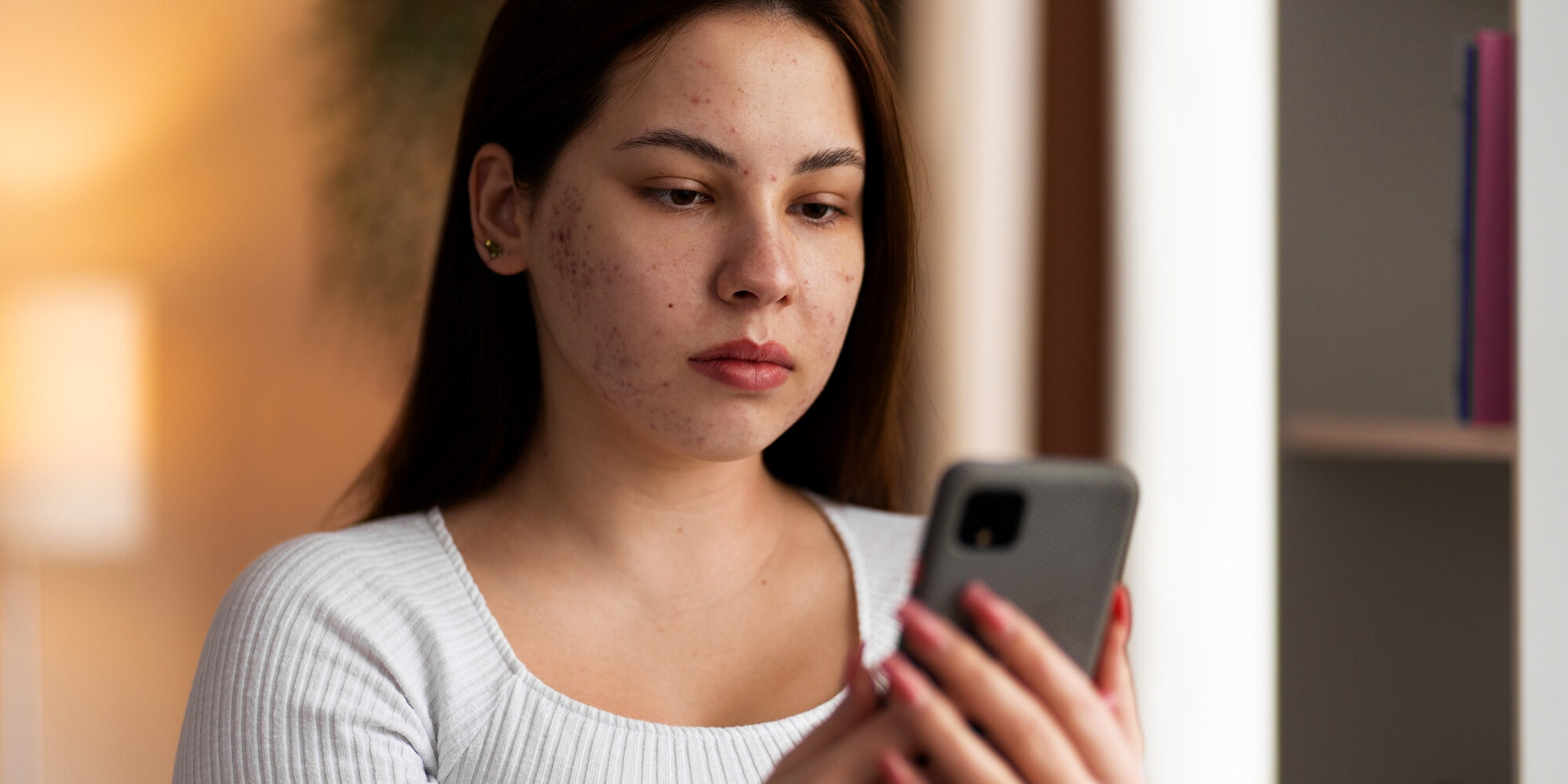 Αν η ακμή ήταν άτομο, θα το είχα μπλοκάρει Αν η ακμή ήταν άτομο, θα το είχα μπλοκάρει