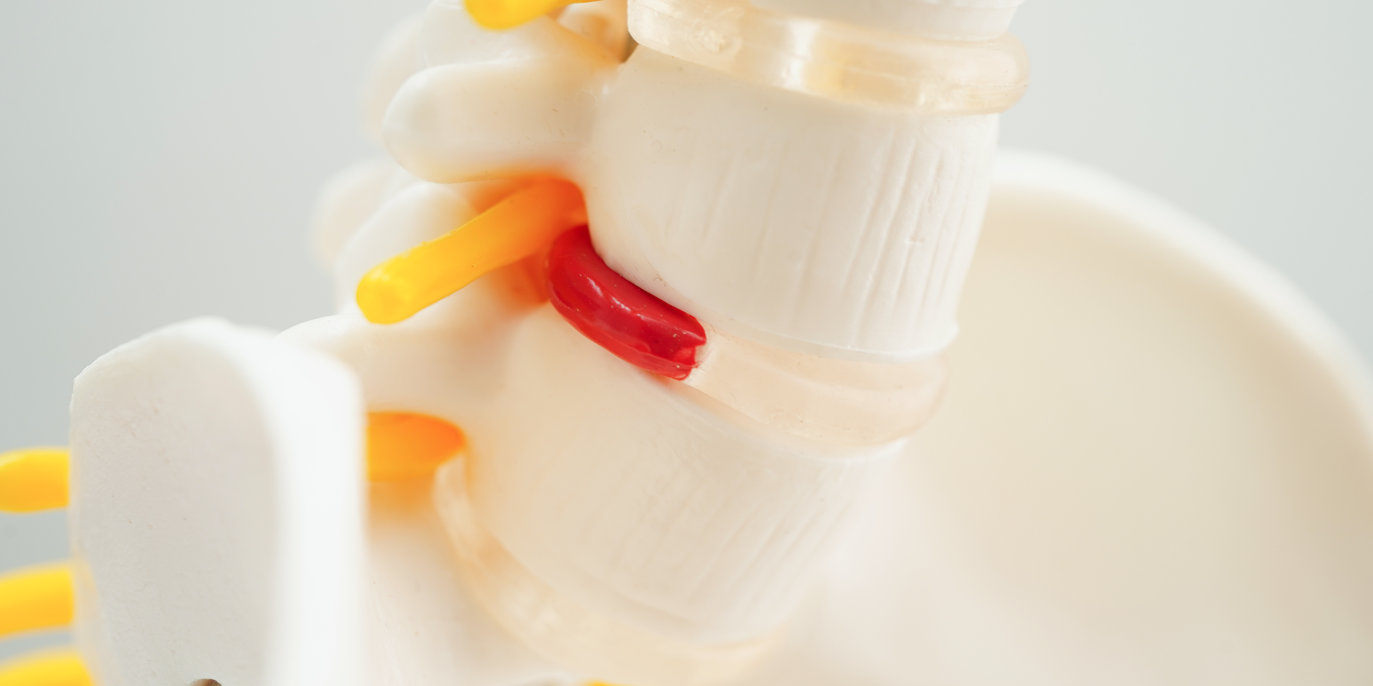 Τι είναι η δισκοκήλη