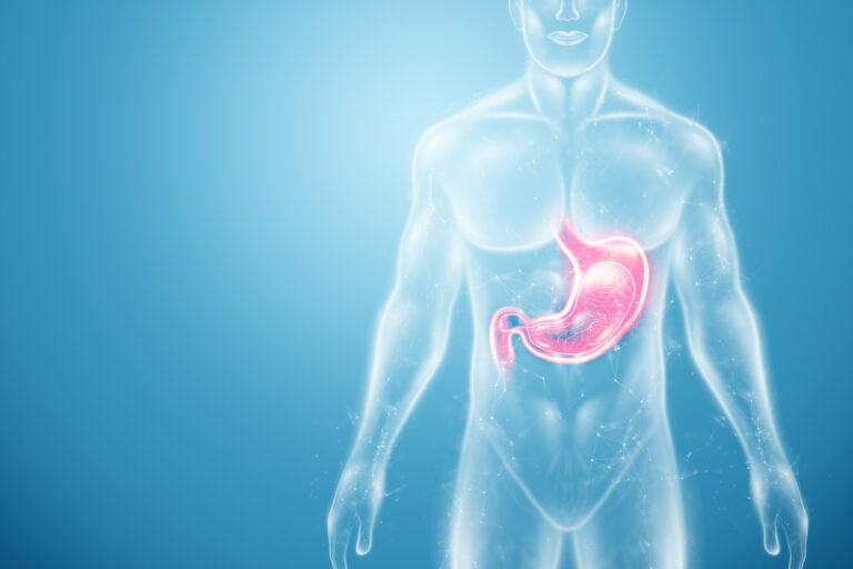 Τι είναι το γαστρικό μανίκι