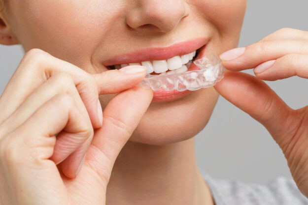 Οι Καλύτεροι Ορθοδοντικοί Invisalign
